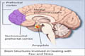 Ptsd-brainthumb